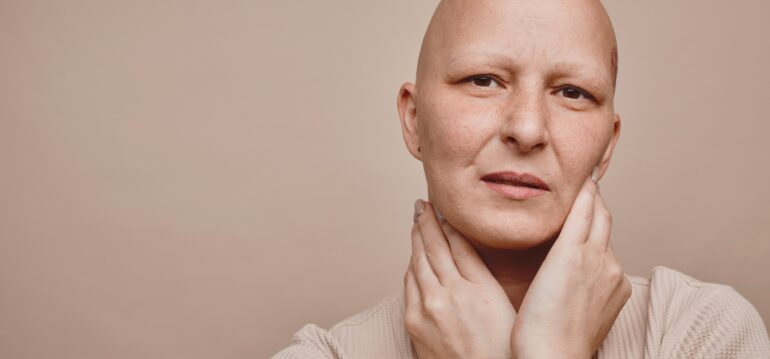 Why Don’t Hair Transplants Work on Alopecia Areata? Find Out Now!