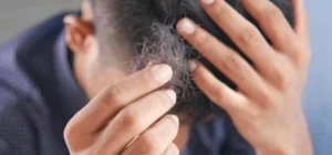 what-makes-hair-follicies-die-img