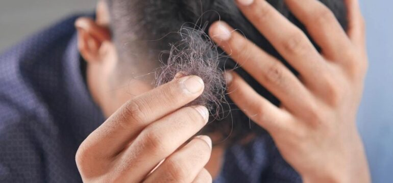 what-makes-hair-follicies-die-img