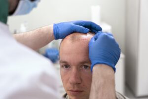 Difference Between Surgical-Vs-Non-surgical-hair-Transplant