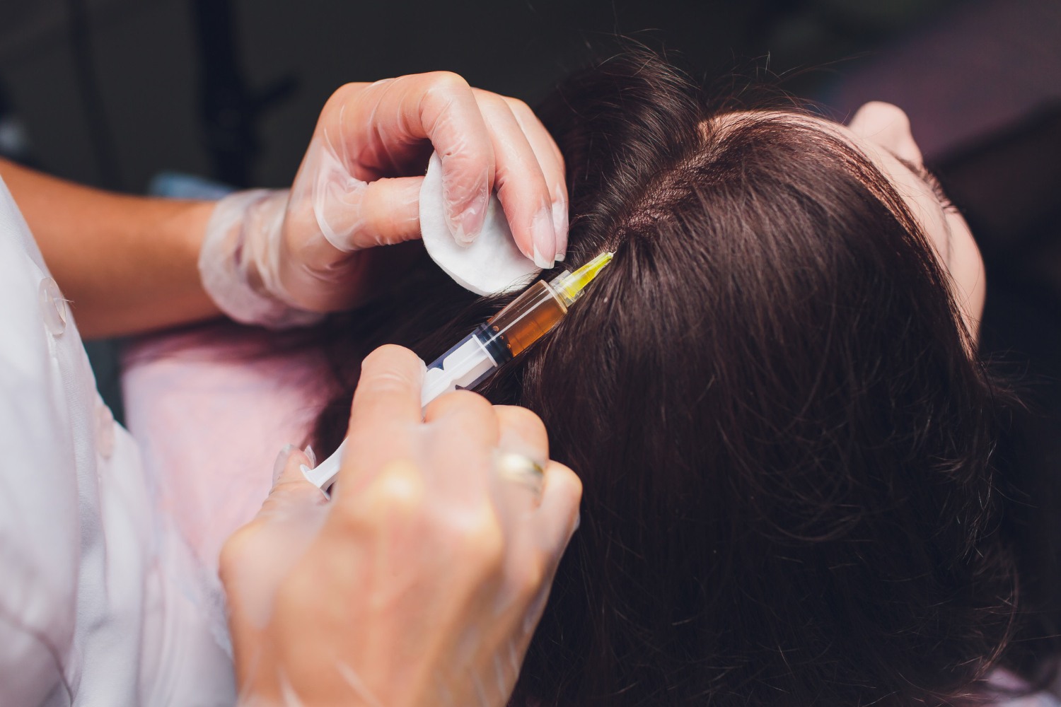 female-hair-transplant-4-img