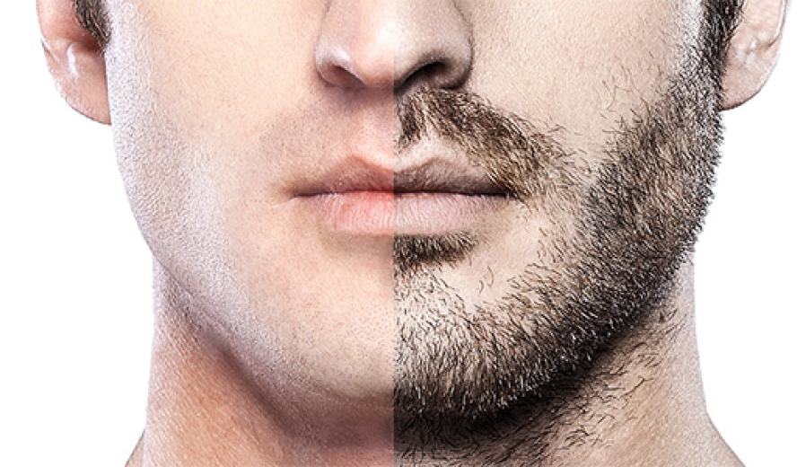 How-many-grafts-do-you-needed-for-a-beard-transplant