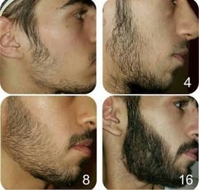 Factors-affecting-beard-transplant-success