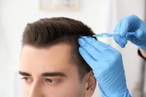Accelerate-Hair-Growth-After-Hair-Transplantation