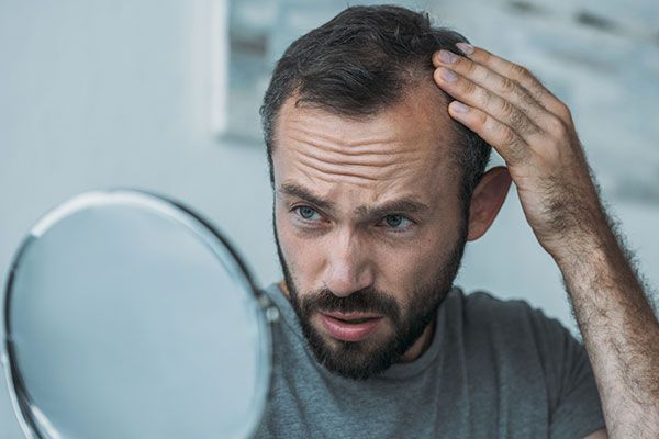 Psychological-Effects-of-Male-Pattern-Baldness?