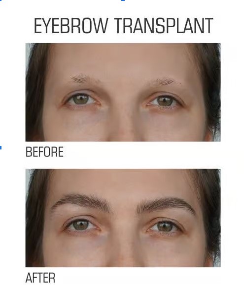 Eyebrow before and after looks
