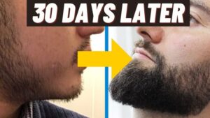 Beard-Growth-Patterns