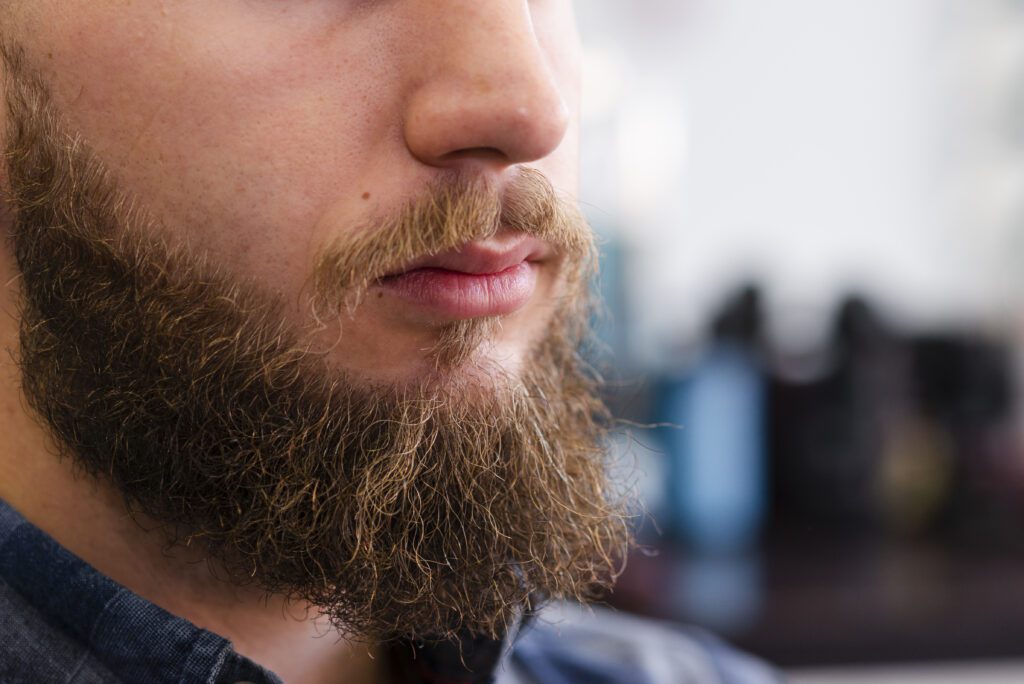 Man Beard Look normal after beard transplant