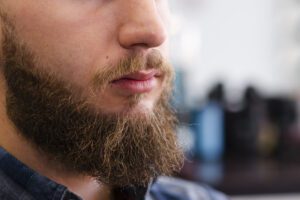 Man Beard Look normal after beard transplant