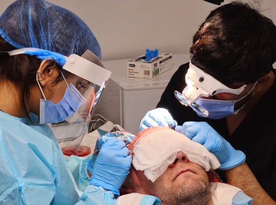 Manual-FUE-Vs-Robotic-FUE
